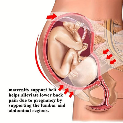 3 in 1 Pregnancy Back Support  Belt Support Child Weight and Relieve Back Preasure 3830-10